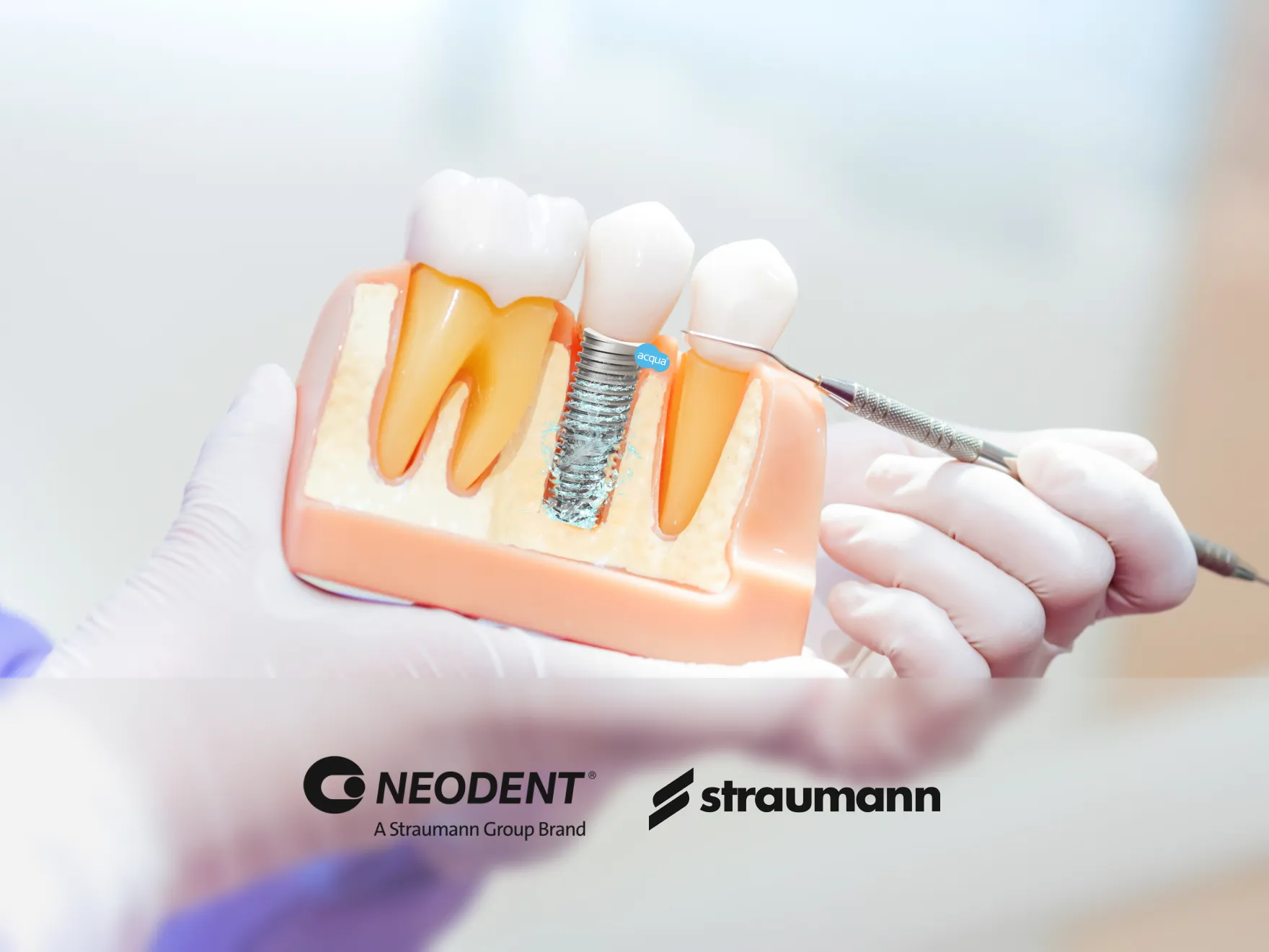 65529c02eb754da1619c7a36_dental-implants-02