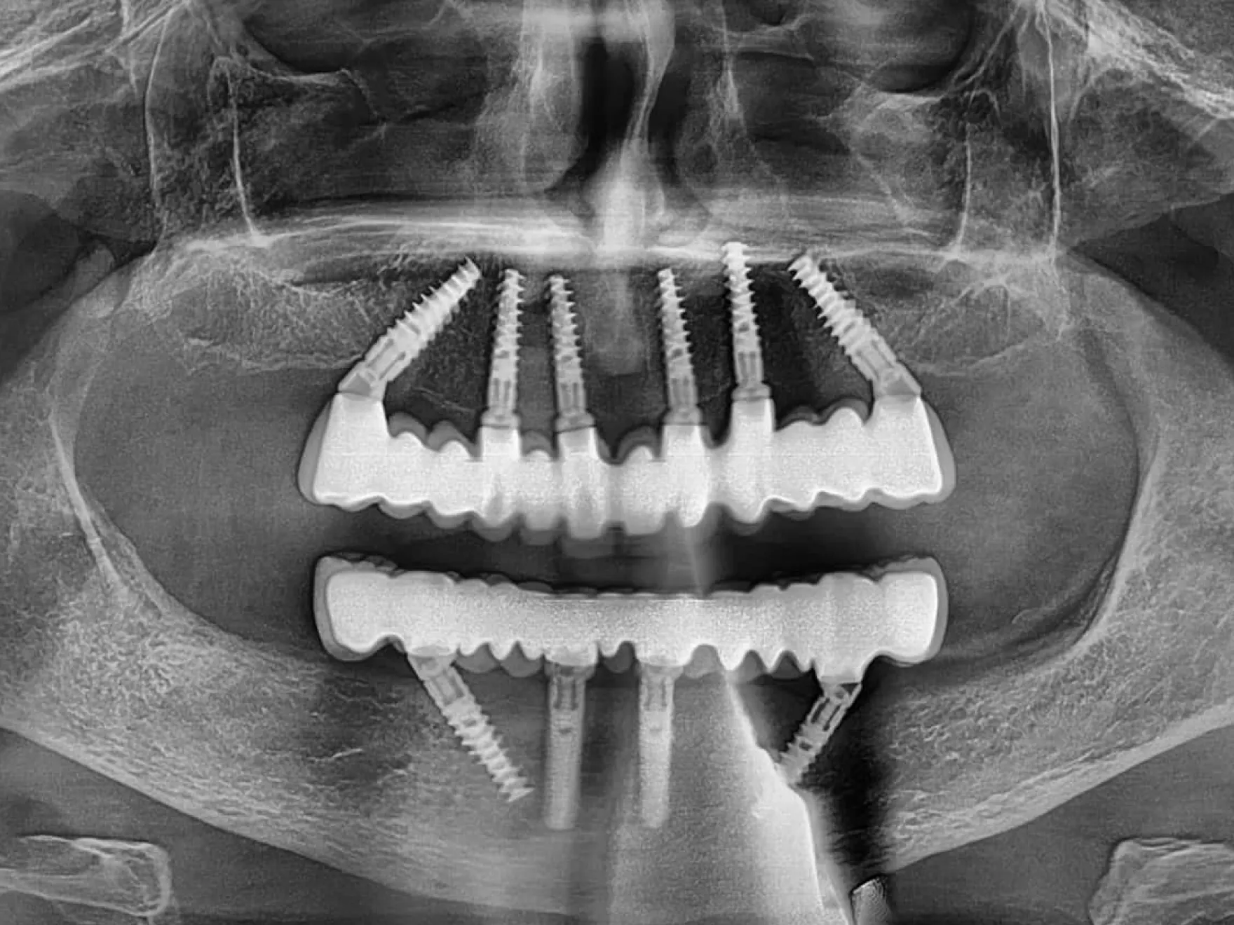 656f33972fbf563e3a728912_other-service-03